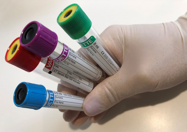 Covid-19 Test| Rheumatologie am Hofgarten